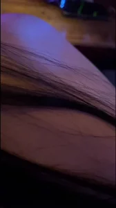 03年微熏医美前台直接拿下